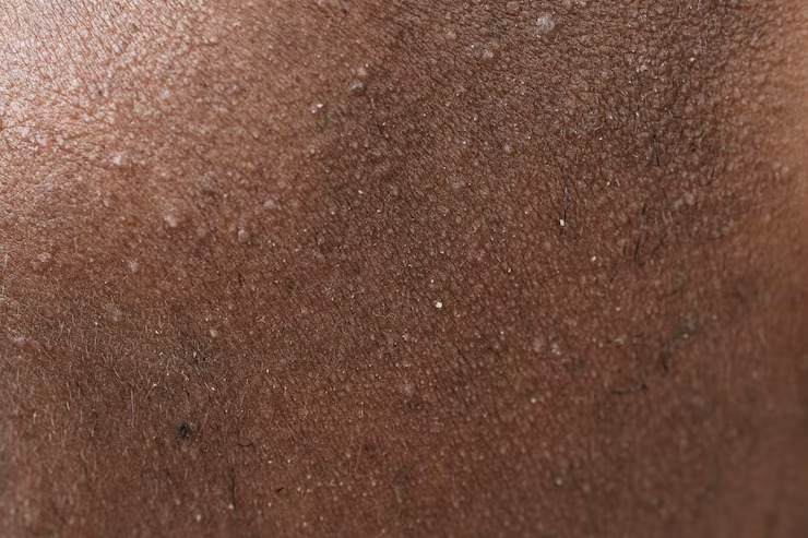 dry skin ke liye winter glow totkay by desiexpert.com