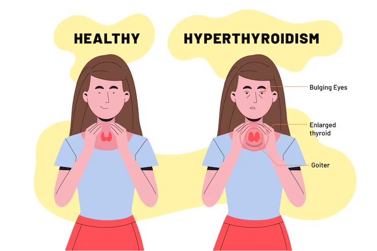 thyroid diet plan Pakistan by DesiExpert.com
