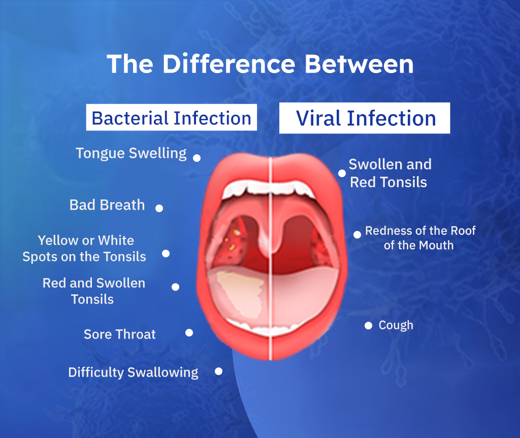 throat infection ka ilaj by DesiExpert.com